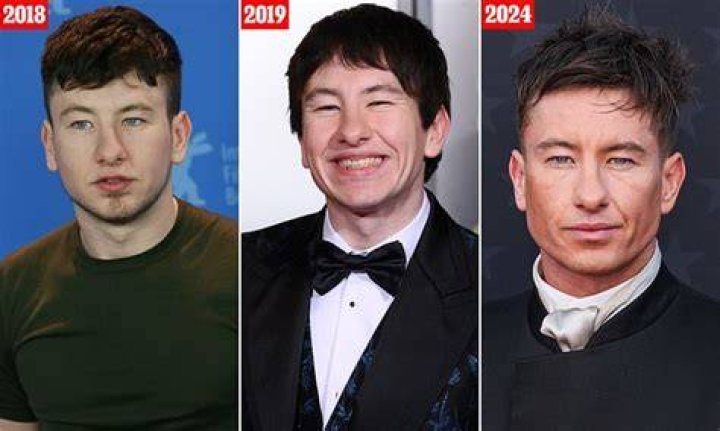 Barry Keoghan's Plastic Surgery: A Look At His Transformation